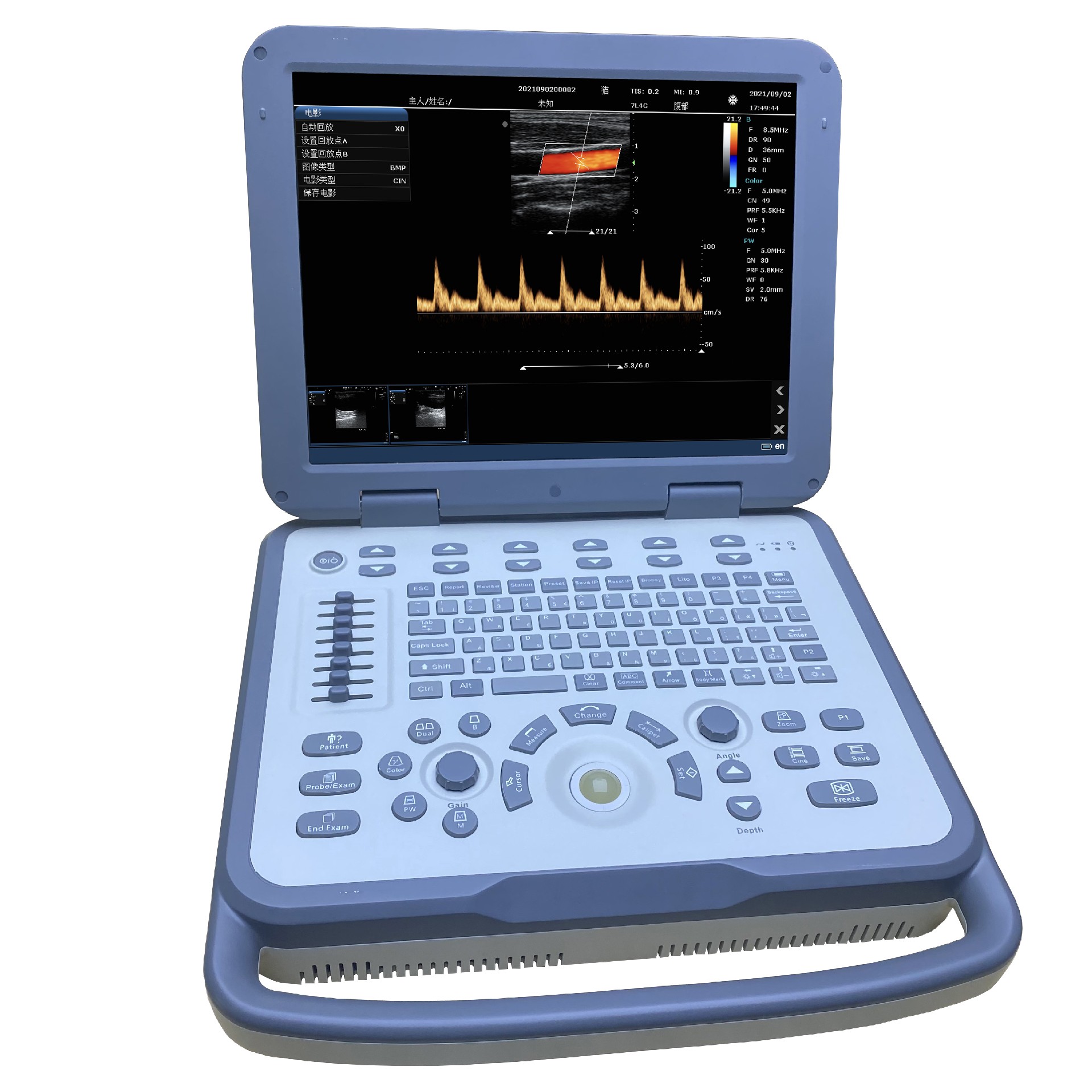N30 Laptop ultrasound