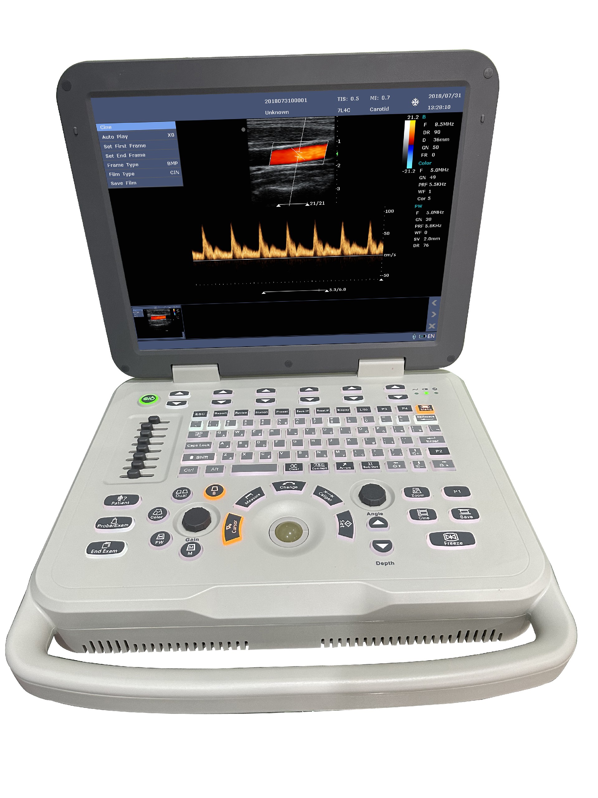 N50 Laptop ultrasound